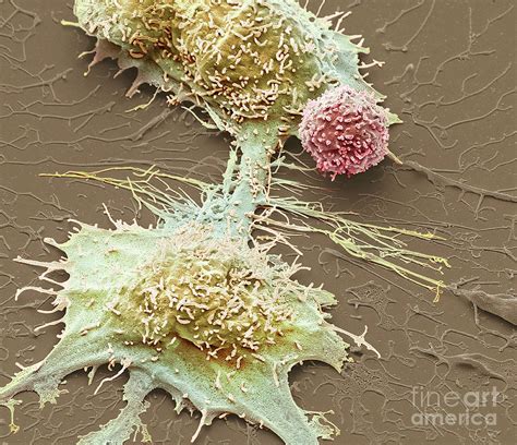 Natural Killer Cell And Cancer Cell Photograph By Steve Gschmeissner