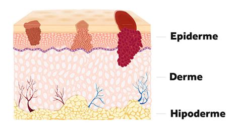 Camadas Da Pele Quais S O Humana Fun O Tipos De C Lulas