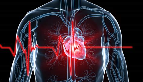 Sudden Cardiac Arrest What Precautions Should A Heart Patient With