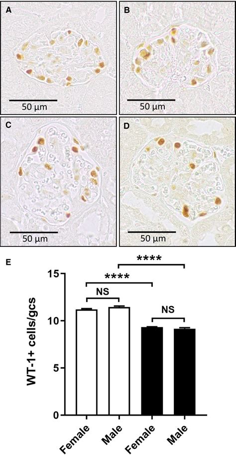 Effect Of Sex On Podocyte Loss In Diabetic Nos3‐‐ Mice Immunostaining