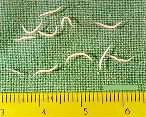 Pinworm Infection Symptoms Anus Diagnosis Treatment