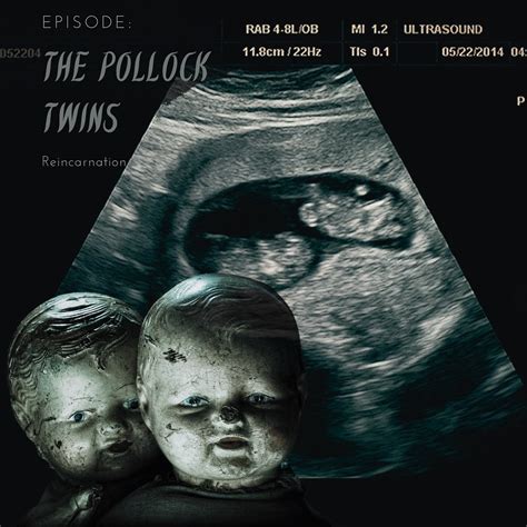 The Pollock Twins The Eerie Story Of Rebirth And Reincarnation