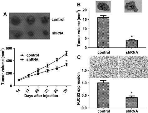 Knockdown Of NUCB2 Impaired The Growth And Metastasis Of Glioblastoma