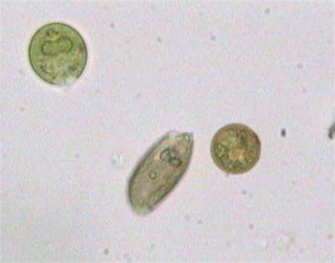 Microscopic Organisms In Pond Water