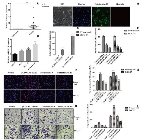 Figure 1 From Exosome Delivered LncHEIH Promotes Gastric Cancer