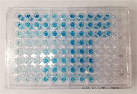 Dna And Rna Isolation Kits At Rs 35000 Packet Isolation Kits In New Delhi Id 12956271491