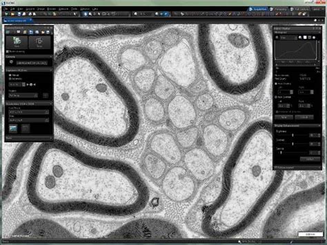 Radius The Future Of Electron Microscopy Software Wiley