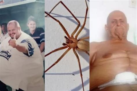 Picada de aranha gordo mais rápido do Brasil pede ajuda