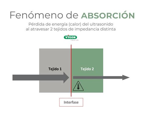 Ecografía en el acceso vascular qué mejora aporta saber cómo se forma