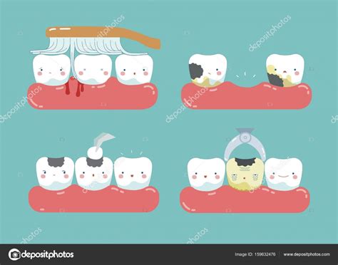 Brushing make hurt gum and teeth, decayed teeth ,filling tooth of dental set Stock Vector by ...