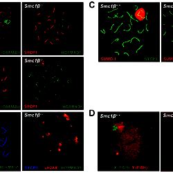 Synapsis defects of autosomes and sex chromosomes of Smc β spermatocytes