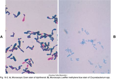 Microbiology Exam 4 Ch 16 Aerobic Gram Positive Bacilli Flashcards