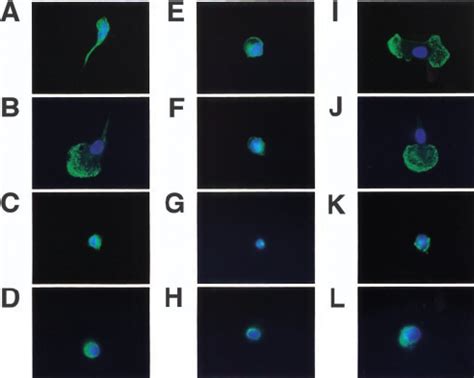 PI 3 K Is Required For Lamellipodium Formation In Infected Monocytes