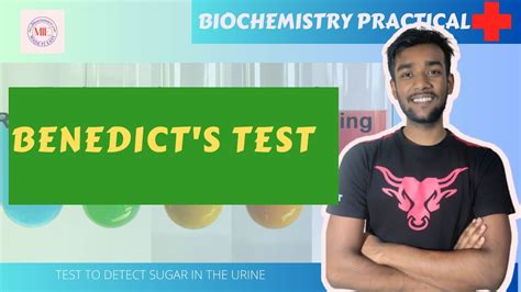 Benedict Test Urine Test For Sugar Biochemistry Practical With