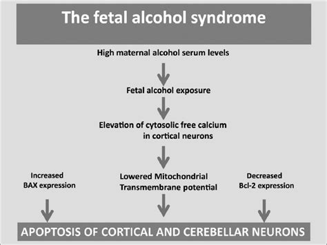 The fetal alcohol syndrome (FAS). | Download Scientific Diagram