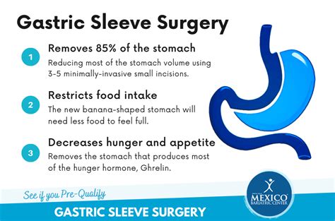 Pros and Cons of Gastric Sleeve Surgery - Is VSG Right for Me?