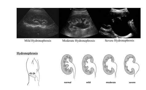 Nephro/Uro Course