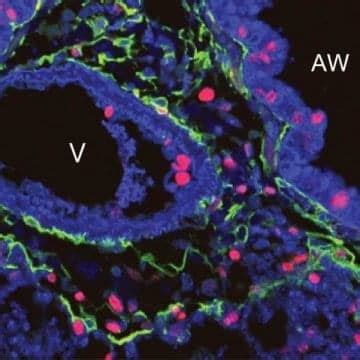 'Sonic Hedgehog' Gene Maintains Repair Process of Adult Lungs | RT