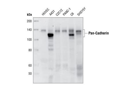 Pan Cadherin E Rabbit Mab Cell Signaling Technology