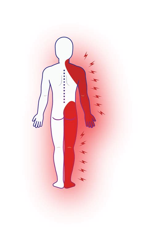 Msk Pain Management Clinic Diagnosis And Treatment Of Chronic Pain