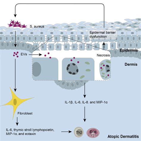 Extracellular Vesicles EVs In The Pathogenesis Of AD On The One