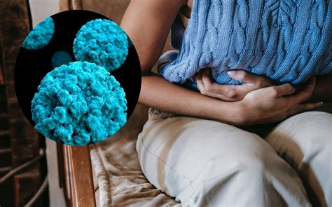 Norovirus síntomas y cómo se contagia CHIC Magazine