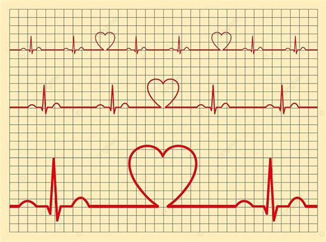 Vector Heart Cardiogram Charts Set Cardiology Rate Electrocardiograph