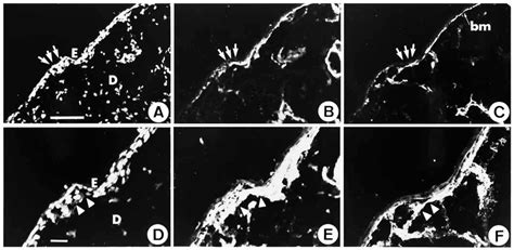 Immunolocalization Of Laminin 5 γ2 Epitope And Integrin α2β1 In