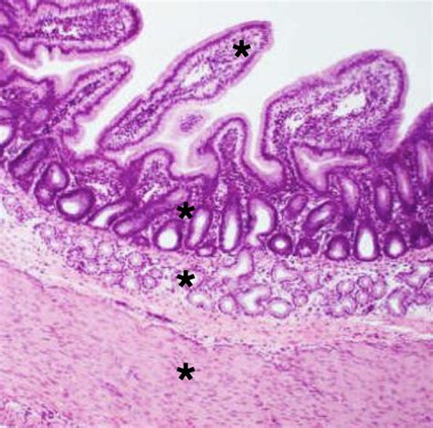 Lab 9- duodenum histology Diagram | Quizlet