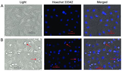 Resveratrol Treatment Induces Apoptosis In Hela Cells Hoechst 33342