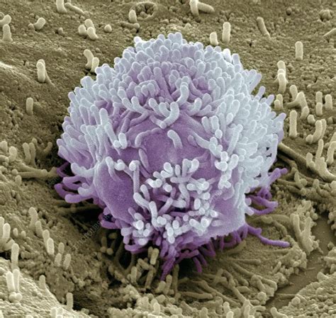 Colorectal Cancer Cell Stock Image C010 7899 Science Photo Library