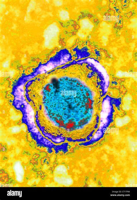 Herpes Simplex Virus Stock Photo Alamy