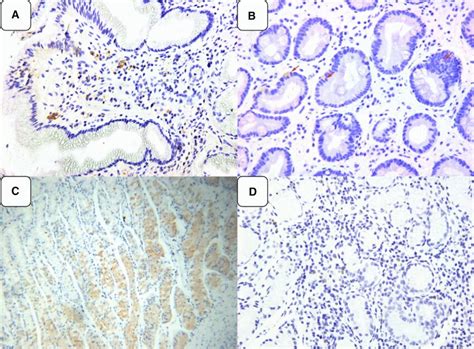 Expression Of Ht In Gastric Mucosa By Immunohistochemistry A