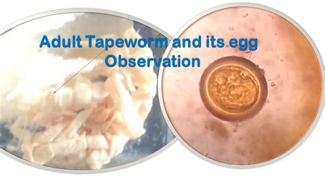 What Do Tapeworm Eggs Look Like In Human Stool - Infoupdate.org