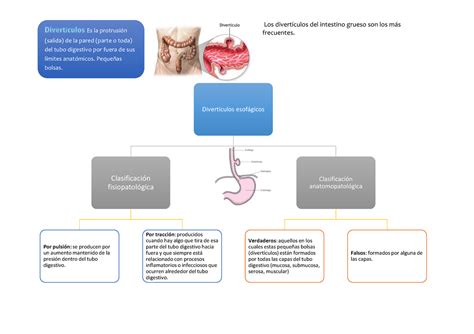 Esquema Diverticulos Patología Gástrica Los Del Intestino Grueso