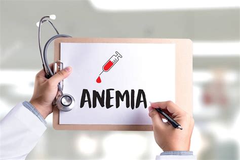 Anemia Sideropenica In Et Pediatrica