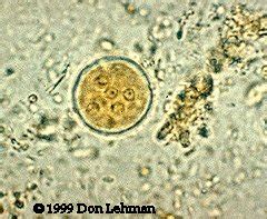 Diagnostic Parasitology; E. coli