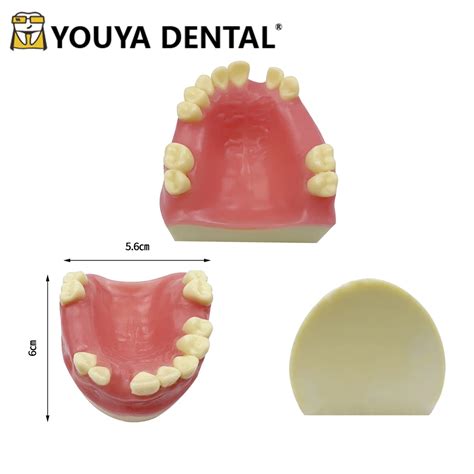 Mod Le D Implant Fuchsia Pour La Formation De Technicien Dentaire Outil