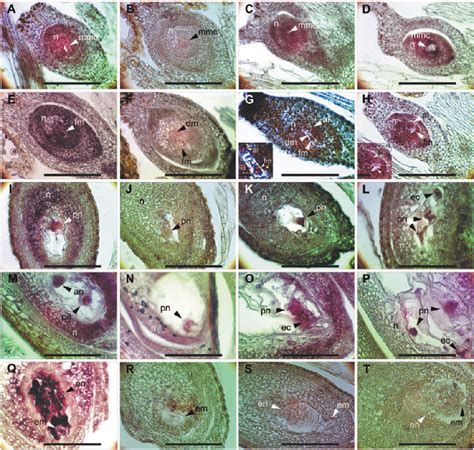 In Situ Hybridization Analysis Of Psorc3 Transcripts In Female