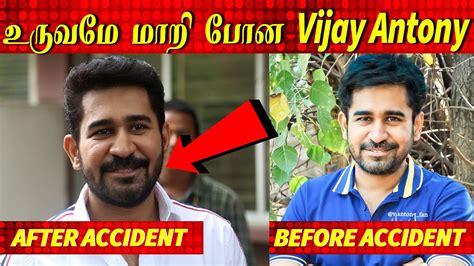 Vijay Antony S Video After His Accident Pichaikkaran 2 Audio Launch