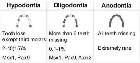 Hypodontia-missing teeth, baby teeth, spaces, implants, orthodontics, restorative dentistry ...