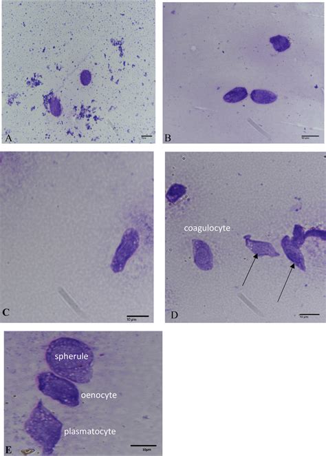 Light microscopy photo, showing types of hemocytes identified from the... | Download Scientific ...