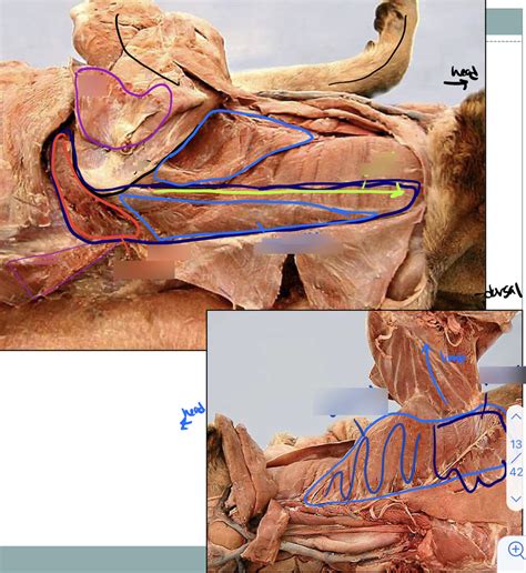 Extrinsic Muscle Diagram Diagram Quizlet