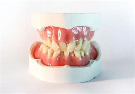 Smile Dental, Dental Care, Dentures, Orthopedics, Panna Cotta, Teeth ...