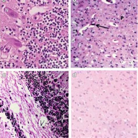 Histopathological Effect Of Se NPs On CdCl2 Induced Renal Damage In