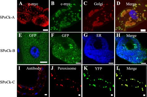 Intracellular Localization Of Spock Isoforms In Vivo Within Principal