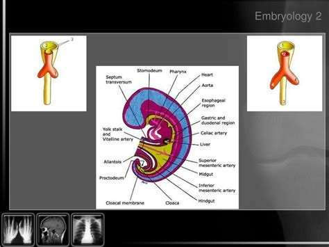 Ppt Oesophagus Powerpoint Presentation Free Download Id2360283