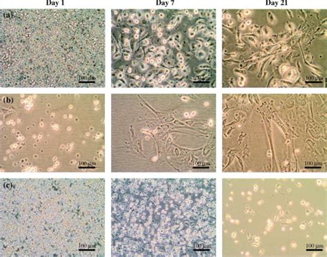 Undifferentiated Mouse Mesenchymal Stem Cells Spontaneously Express