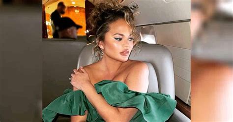 Chrissy Teigen Reveals She Has Fat Removed From Her Face And The