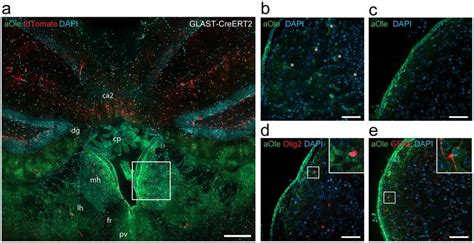 The Alkyne Lipid Uptake To The Medial Habenula In Vivo Corresponds To Download Scientific